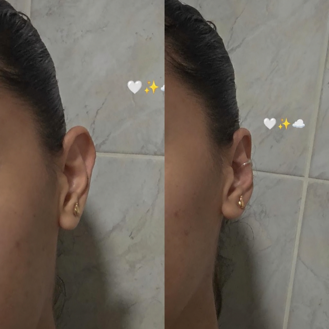 Fotos compartilhadas da posição da orelha com OttoFlex